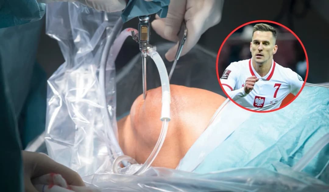 Najszybsza artroskopia kolana NFZ – terminy i dostępność w Polsce